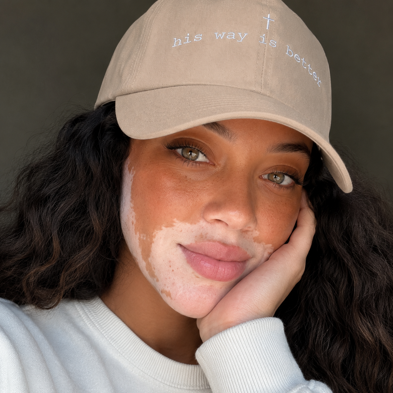 A close-up portrait of a woman wearing a beige baseball cap with white embroidered text reading 'his way is better' and a small cross, along with a white sweatshirt. Her face has a distinctive white burn scar on the cheek.